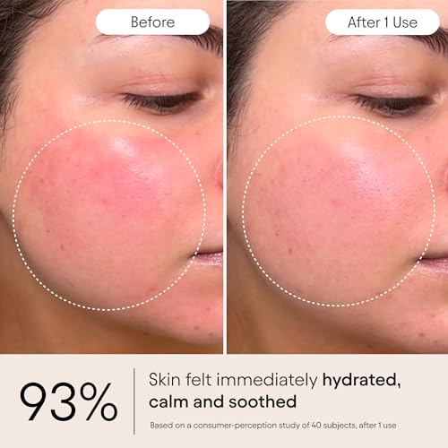 Alpyn Super Peptide & Ghostberry Moisturizer for Eczema, Barrier & Wrinkle Repair | Calm & Soothe Against Redness & Irritation | 1.7 oz / 50 ml
