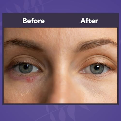 NOVEHA Lavender and Tea Tree Oil Eyelid Foaming Cleanser | Hydrating Hypoallergenic Daily Soap For Eyelashes and Lids, For Demodex, MGD, Stye Eye, Eye Irritations & Dry Skin | 3.38 fl oz (3PK - 100ml)