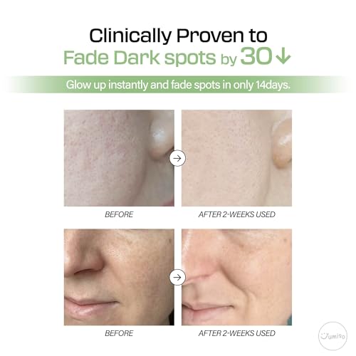 All Day Pure C 5.5 Glow Serum 30ml | Aronia Fruit Extract | Pure Vitamin C (L-Ascorbic Acid) with Alpha-Arbutin&Ascorbyl Glucoside | fragrance-free, parabens-free | 1.01 fl oz, 30 ml
