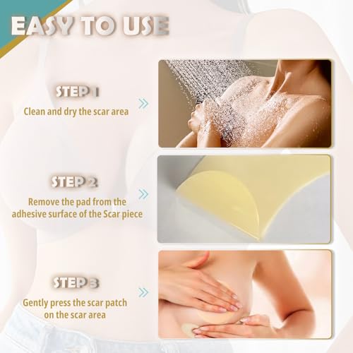 Silicone Scar Sheets for Breast, 8 Pieces Of Reusable Silicone Breast Scar Sheets, Effective Postoperative Scar Healing Solution, Promote Healing, Reduce Scar Appearance, Scar Care