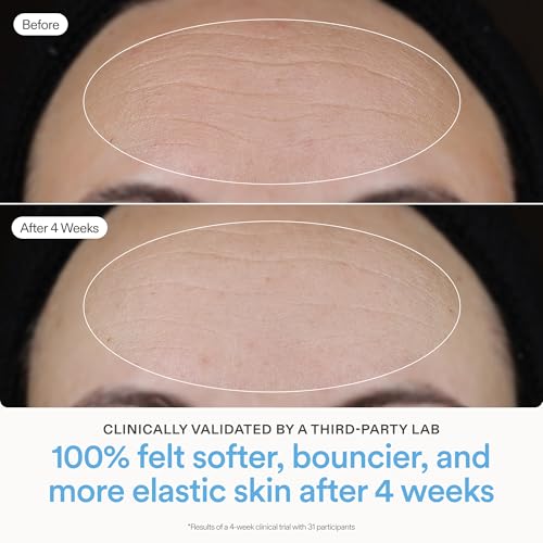 Skinfix Ceramide Prime Whipped Cream - 1.7 oz - Lightweight Moisturizer for Face with Niacinamide + Peptides - Non-Comedogenic, Fragrance Free, Vegan, Cruelty Free
