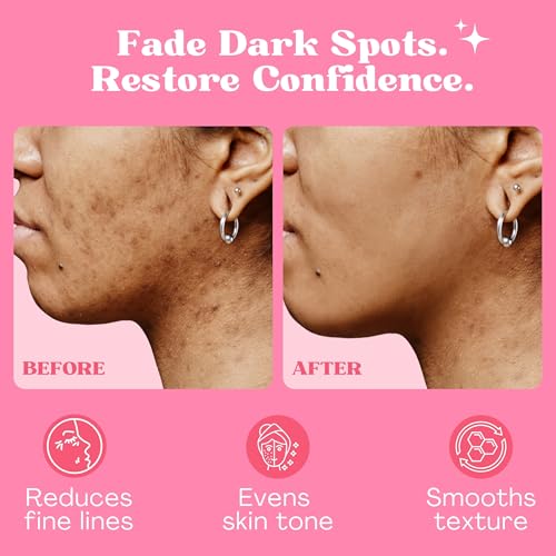 Brightening Serum with Coconut Oil, Vitamin E, and AHA ? 1 fl oz