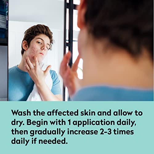 All Acne Treatment - Face and Body - Spot and Full Coverage - Gel Formula - 9 Skin Boosters