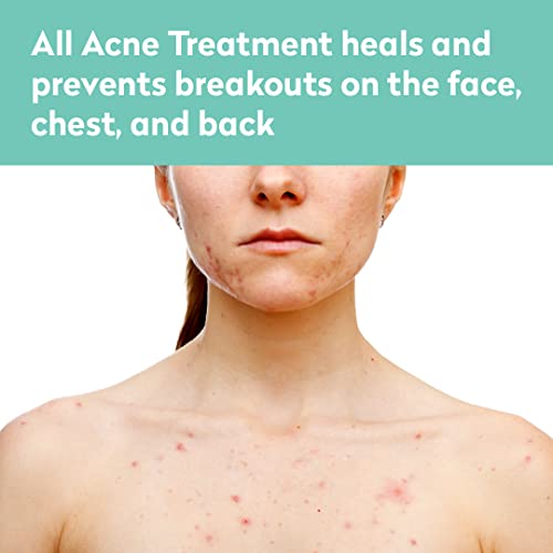 All Acne Treatment - Face and Body - Spot and Full Coverage - Gel Formula - 9 Skin Boosters
