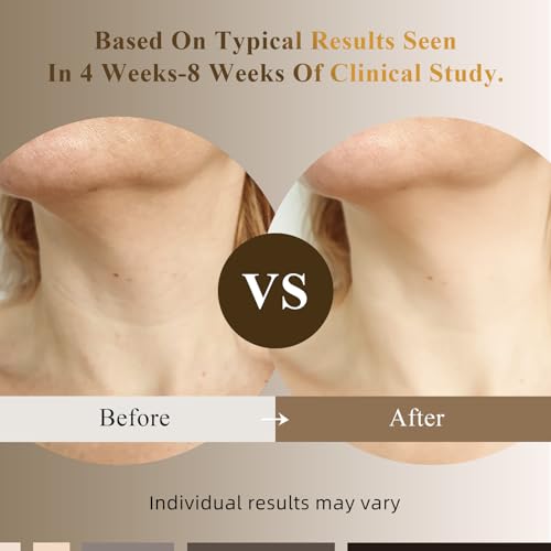 Neck Firming Cream 3.4oz ? Tightening & Lifting Neck Cream for Sagging, Crepey Skin ? Double Chin Reducer & Wrinkle Cream for Women ? Beauty & Personal Care, Korean Neck Tightening, Skin-Tight Look
