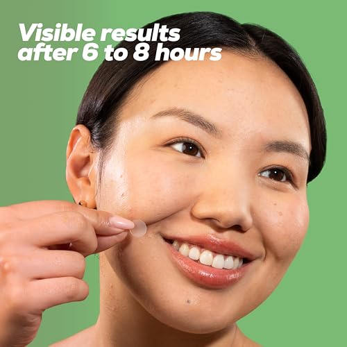 HANHOO Soothing Blemish Patch with Aloe, Madecassic Acid, and Tea Tree Extract | Hydrocolloid Spot Treatment | Calms Pre-stage, Irritated, and Popped Blemishes 216 count