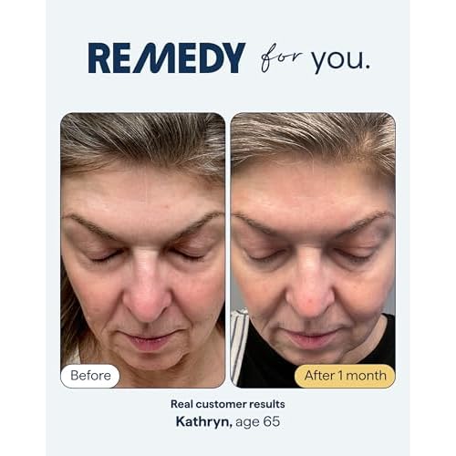 Remedy for Healthy Aging - Retinal, Resveratrol, Glycolic Acid, Argireline, Ferulic Acid, Matrixyl 3000 - Anti-Aging Treatment for Wrinkles, Uneven Texture & Tone - By Dermatologist Dr. Shah