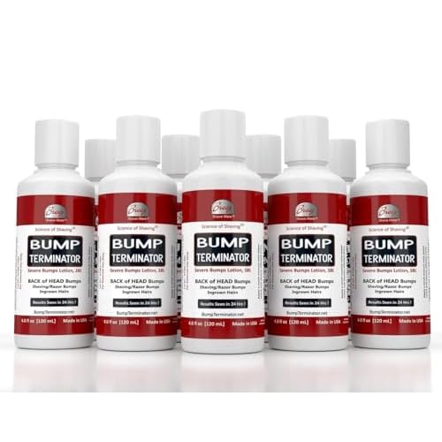 BUMP TERMINATOR Severe Bumps Treatment | Razor Bumps And Ingrown Hair Treatment | Bikini Bumps | Back of Head Bumps And Ingrown Hair Treatment, 4 oz (Pack of 1)