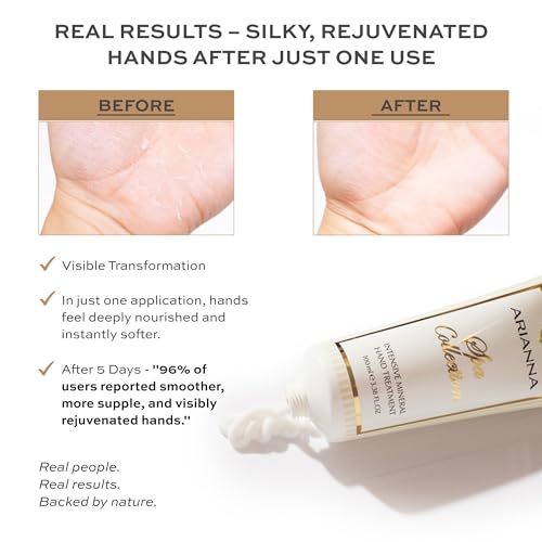 Intensive Mineral Hand Treatment Natural Vegan Cream Dead Sea Water Minerals Hand Moisturizer For Smooths Rough Irritated and Dry Skin