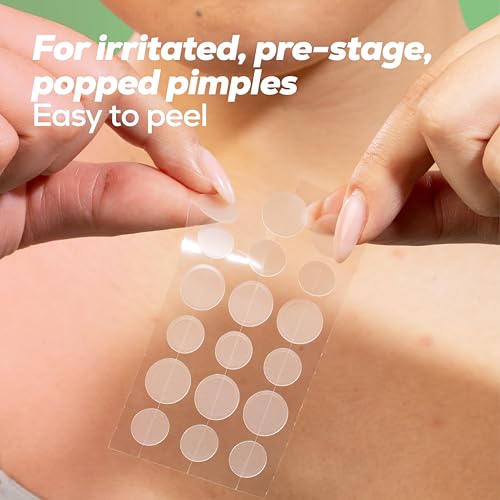 HANHOO Soothing Blemish Patch with Aloe, Madecassic Acid, and Tea Tree Extract | Hydrocolloid Spot Treatment | Calms Pre-stage, Irritated, and Popped Blemishes 216 count