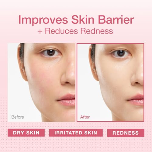 Physiogel Redness Reducing Cream ? Ceramide Moisturizer for Dry, Sensitive & Redness-Prone Skin, Repairs Skin Barrier, Dermatologist-Tested, Fragrance-Free, Korean Skincare, 3.4 fl oz (Pack of 2)