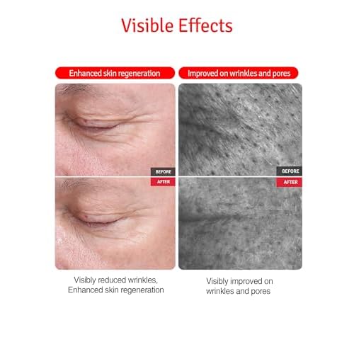 VITABRID C12 Wrinkle Cream - Age Defying Skin Recovery Moisturizer with Peptides, Vitamin C, Shea Butter - Wrinkle Repair Moisturizing Day & Night Skincare for Face and Neck - Fragrance Free, 1.69oz.