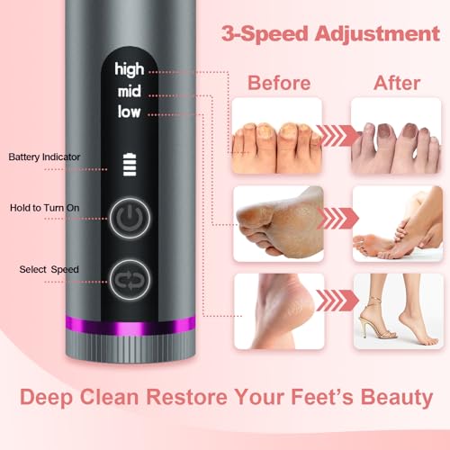 Electric Foot Callus Remover with Nano-Glass Head, Cordless Electric Foot File with 2600mAh Battery, Electric Callus Remover for Feet with 3 Adjustable Speeds, Pedicure Tools for Feet