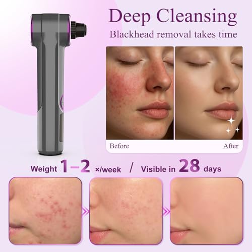 Blackhead Remover Vacuum, Pore Vacuum Cleaner with Heating, 3 Suction Levels & 9 Modes, Facial Pore Cleaner Tool for Nose, T-Zone, Chin, 5 Replaceable Heads, USB Rechargeable Comedone Extractor Kit