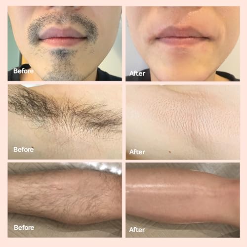 Allongs hard wax 200g | Waxing Beads for women men Professional Salon Quality | Perfect for Full Body | Facial | Brazilian Bikini | and Legs at Home Wax Refill (pink) Korean Beauty Olive Young
