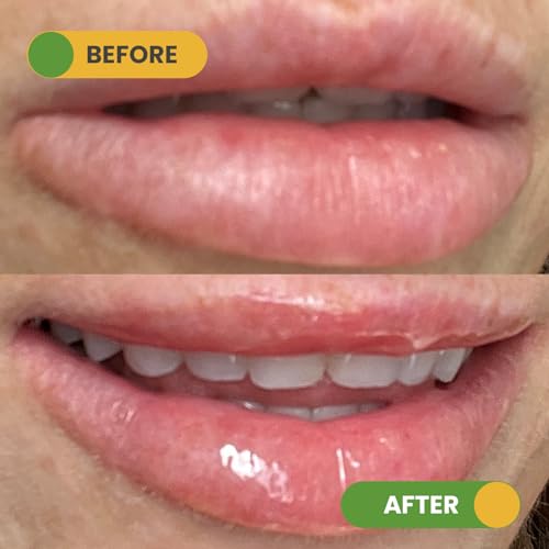 Mango Lip Mask & Scrub Duo ? Hydrating & Exfoliating Lip Care with Omega Fatty Acids, Organic Oils & Organic Shea Butter ? Soft, Smooth, Plump Lips ? Vegan & Paraben-Free, No Nasties
