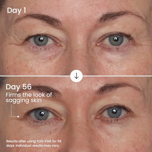 MA?LYS TOO-FINE Face Serum for Women - Firming Anti-Aging Serum with Glaucine & Bacillus Ferment - Helps Lift the Look of Sagging Skin on Jawline, Cheekbones & Under Eyes (15 mL)