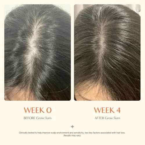 Growturn Hair Growth Serum with Built in Brush for Hair Growth & Thickening | Treatment for Thinning Hair, Hair Loss | Low Irritation, Fragrance-Free, Sulfate & Paraben-Free, 3.38 fl. oz. (Pack of 1)