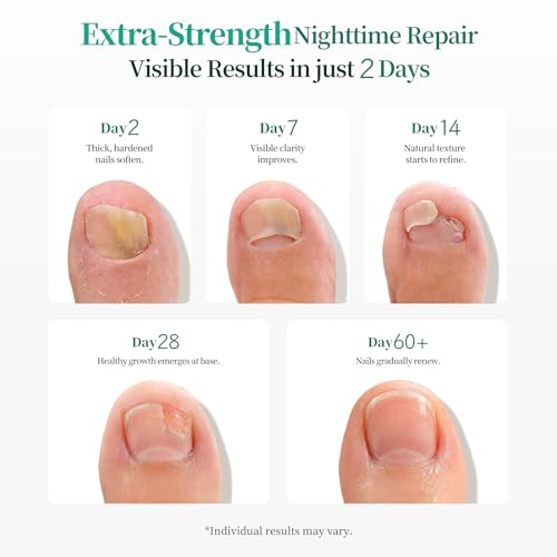 APUREE Fungal Nail Patches Extra Strength: True 1% Tolnaftate | 8H Overnight Fungal Toe Nail Treatments |Repair For Discolored Yellow Brittle Damage Nails| Revives Natural look| 64 Patch