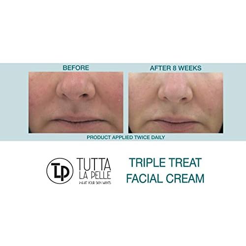Anti Aging face Cream TRIPLE Antioxidant Treatment Serum For Face, Resveratrol + Green Tea + Caffeine - Visibly Reduce Skin Redness & Calm Irritation -For Sensitive Rosacea Skin -1oz