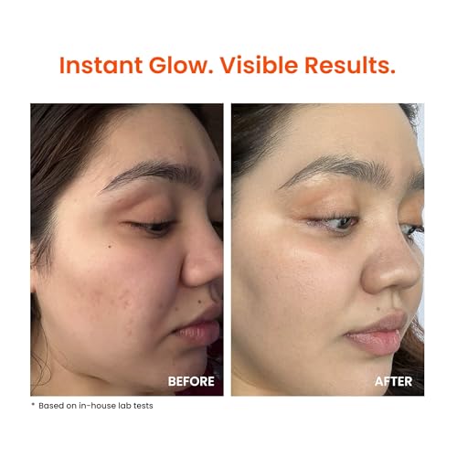 FoxTale Vitamin C Super Glow Moisturizer with Niacinamide & Peptides, Visibly Reduces Pigmentation, Enhances Skins Brightness Instantly, For All Skin Types, Women & Men (50ml)