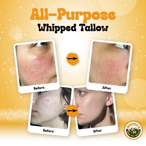 Magic Moo All Purpose Whipped Beef Tallow Skincare for Acne, Eczema, Dry Skin, Moisturizer, Stretch Marks & Hydration. Suet Tallow for Face with Organic Emu Oil. Contains All Organic Ingredients, 2oz