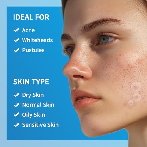 Pimple Patches for Face Hydrocolloid Acne Patches, Invisible Zit Stickers Covering Blemishes, 3 Size Hydrocolloid Spot Stickers for Face and Skin (144 Count(Pack of 1))