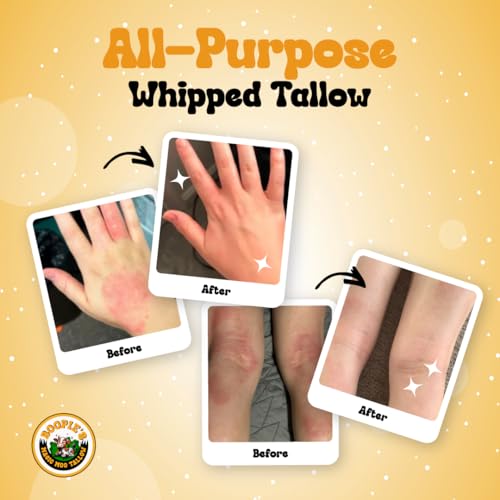 Magic Moo All Purpose Whipped Beef Tallow Skincare for Acne, Eczema, Dry Skin, Moisturizer, Stretch Marks & Hydration. Suet Tallow for Face with Organic Emu Oil. Contains All Organic Ingredients, 2oz