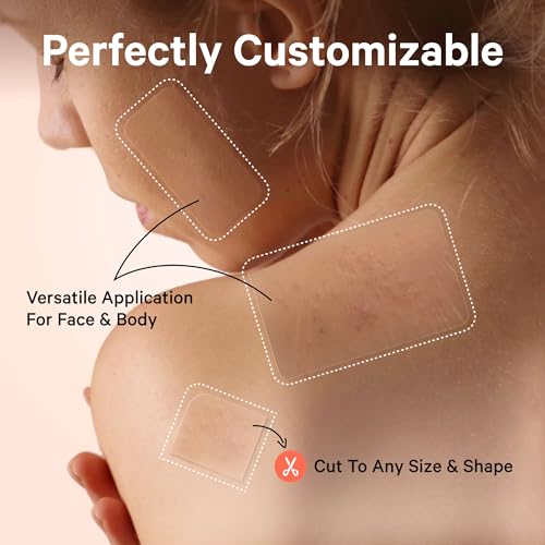 Sosky Large Pimple Patches XL Hydrocolloid Acne Patches for Face & Body Cystic Pimple & Zit Patch for Nose Chin Back, Bacne & Breakouts Vegan Cruelty-Free£¨10 Count£©