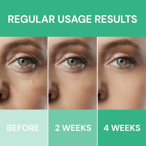 Retinol Cream for Face: Anti-Wrinkle Moisturizer for Deep Wrinkles, Dry Skin & Neck Firming for Men & Women