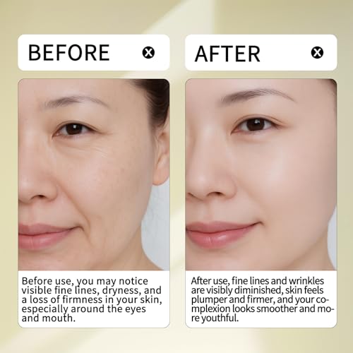 Anti-Wrinkle Serum 18% Active ? 10% Pro-Xylane, 1% Retinol, 5% Squalane & Peptide Complex for Firmer Skin, Smoother Fine Lines, Barrier Support