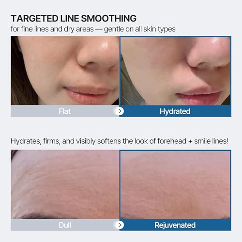 Wrinkle Patches for Forehead and Smile Line Patches 36 PCS with Hyaluronic Acid, Collagen, Peptides - Anti Wrinkle Patches - Face Tape for Wrinkles Overnight - Smoothing, Firming & Moisturizing