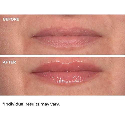 NassifMD Hydro-Screen for Lips