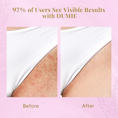 Cyperus Rotundus Serum Roll-On ? Ingrown Hair & Razor Bump Treatment, Natural Hair Growth Inhibitor & Smoothing Solution for Sensitive Skin, Non-Greasy Post Hair Removal Care(60ml)