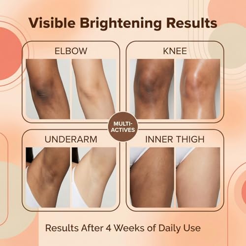 Dark Spot Remover for Body, Lightweight Fast-Absorbing Cream for Uneven Skin Tone, Dark Spot Corrector for Elbows, Knees, Underarms & Inner Thighs, 1.76 Fl Oz