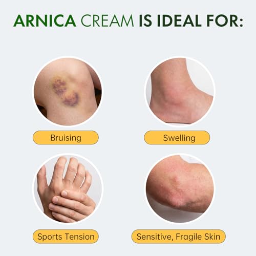 Arnica Cream for Bruising and Swelling & Body Muscle Relief, Soothing Hydrating Formula with Magnesium and Vitamins K, C & E, Suitable for Thin and Sensitive Skin for All Ages, 4 Oz