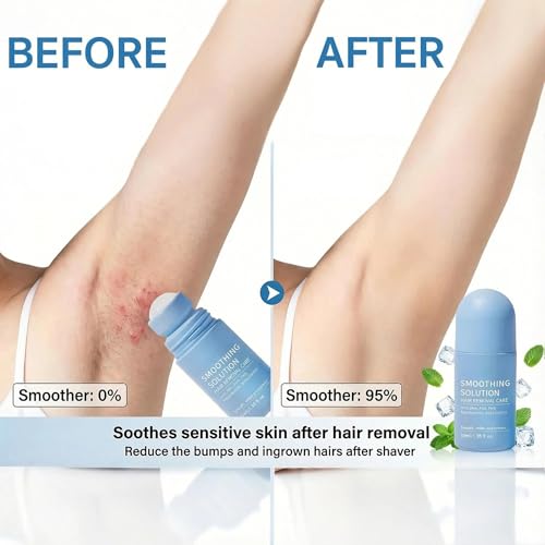 Ingrown Hair Treatment Serum ? Smoothing Solution for Razor Bumps & Hair Removal Aftercare | Hydrating Care for Underarms, Legs, Bikini Line & Arms