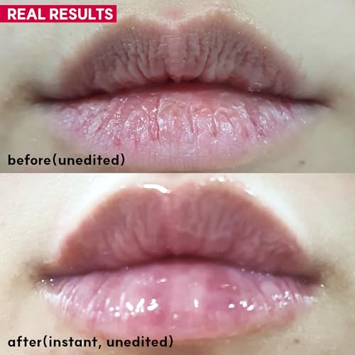 Black Chokeberry Nordic Night Lip Shield - Lip Butter, 8hrs Intensive Care with Aronia fruit extract, Nourishing & Moisture Hydrating Overnight, Korean Skin Care, 0.72 fl.oz