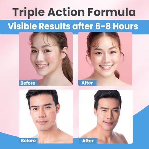 Invisible Hydrocolloid Pimple Patches for Face ? Triple Action Acne Protection, Makeup Cover, 6X Advanced Absorption Technology, Waterproof & Sweatproof, Travel-Friendly (2 Sizes, 72 Count)