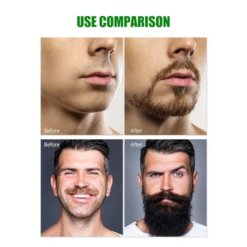 AICHUN BEAUTY Beard Growth Shampoo Soap Deep Cleanse Repair Damaged Beard Refreshing Facial Hair 100g / 3.5oz