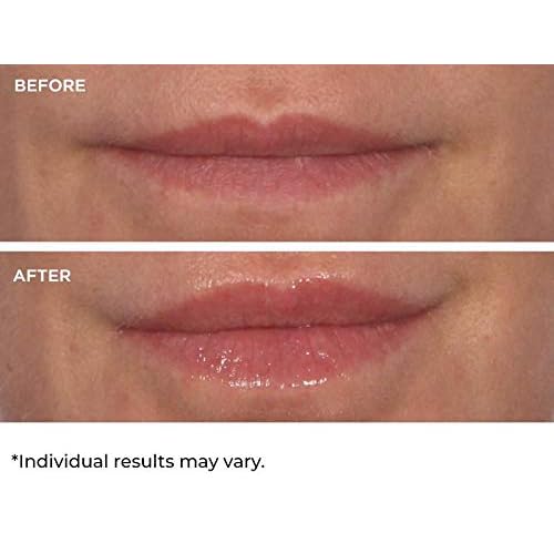 NassifMD Hydro-Screen for Lips