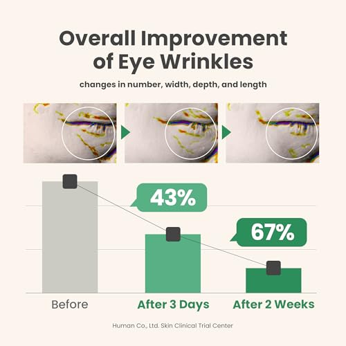 L'Oreal Paris Wrinkle Expert 55+ Anti-Wrinkle Eye Cream with Calcium, Reduce Crow's feet, 0.5 Oz