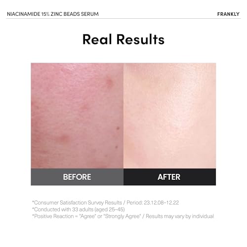 FRANKLY Niacinamide 15% + Zinc Bead Serum Jumbo | High-Dose Yet Gentle Skin Repair | Acne, Pore & Redness Control | Bead-to-Skin Delivery System for Fresh Niacinamide | Korean Skincare | 2.02 fl.oz