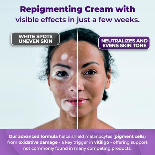 Yves Rocher Pure Calendula Regenerating Moisturizer Day/Night Cream, 50 ml./1.6 fl.oz.
