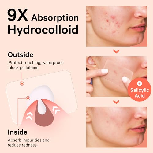Sosky Large Pimple Patches XL Hydrocolloid Acne Patches for Face & Body Cystic Pimple & Zit Patch for Nose Chin Back, Bacne & Breakouts Vegan Cruelty-Free£¨10 Count£©