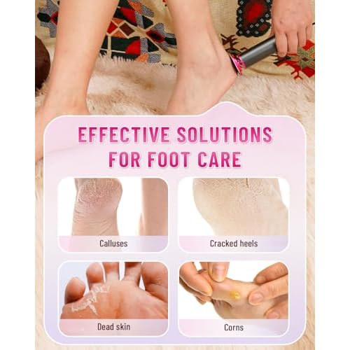 DERMAWAVE Electric Callus Remover for Feet? FSA Eligible, Professional Pedicure Tool with 60 Sandpaper Discs & Speed Controller for Men & Women ? Aluminum Foot File Sander Grinder for Dead Skin