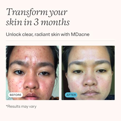 MDacne 3 Step Face Acne Treatment Kit, Benzoyl Peroxide Cream 2.5%, Salicylic Acid Cleanser, Niacinamide Moisturizer ? Medicated Plant-Based Skincare for Adult & Teen Acne, 60 Day Kit