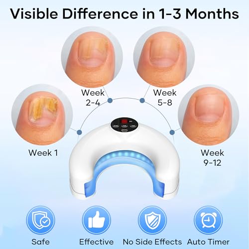 Home Toenail Repair Treatment for Multiple Toenails & Fingernails, Three Modes 3/5/10 Minutes, Rechargeable