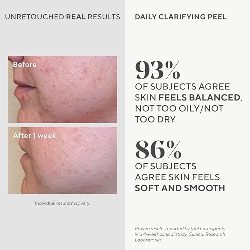 Murad Daily Clarifying Peel ? Retinoid, Salicylic and Glycolic Acid, AHA/BHA Exfoliating Liquid Solution for Softer, Smoother, Hydrated, Pore-Refined Skin ? 3.2 Fl Oz