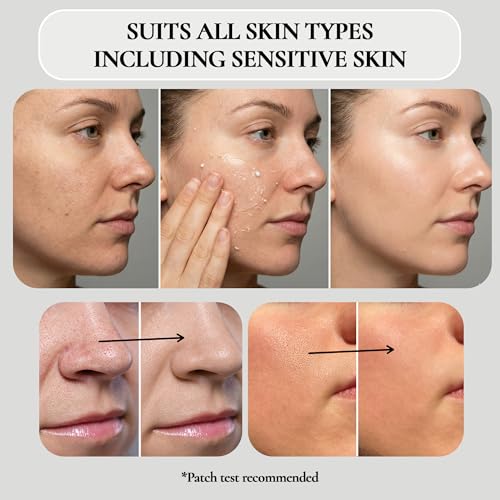 TruSkin Vitamin C Face Wash Cleanser - Brightening Facial Cleanser with Vitamins C & E, Rosehip Oil & Aloe - Gently Cleanses & Refreshes for Radiant-Looking Skin, 5 fl oz